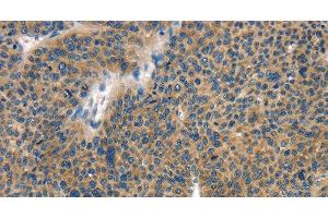 Immunohistochemistry (Paraffin-embedded Sections) (IHC (p)) image for anti-Collagen, Type IV, alpha 2 (COL4A2) antibody (ABIN7238837)