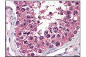 Immunohistochemistry (IHC) image for anti-Uracil-DNA Glycosylase (UNG) (AA 1-313), (N-Term) antibody (ABIN317576) (UNG 抗体  (N-Term))