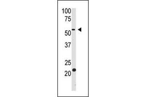 The anti-BACE2 Ctr Pab (ABIN390067 and ABIN2840591) is used in Western blot to detect BACE2 in HL60 cell lysate. (BACE2 抗体  (AA 336-365))