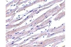 Image no. 1 for anti-Apoptotic Peptidase Activating Factor 1 (APAF1) (AA 12-28) antibody (ABIN205853) (APAF1 抗体  (AA 12-28))