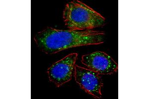 Fluorescent confocal image of U251 cell stained with ZNF81 Antibody (N-term). (ZNF81 抗体  (N-Term))