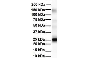 WB Suggested Anti-Tmed1 antibody Titration: 1 ug/mL Sample Type: Human liver (TMED1 抗体  (N-Term))