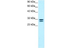 WB Suggested Anti-HTATIP2 Antibody Titration:  0. (HIV-1 Tat Interactive Protein 2, 30kDa (HTATIP2) (N-Term) 抗体)