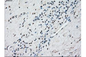 Immunohistochemical staining of paraffin-embedded Kidney tissue using anti-STAT1 mouse monoclonal antibody. (STAT1 抗体)