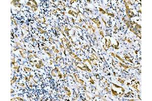 IHC analysis of Filamin B/FLNB using anti-Filamin B/FLNB antibody (ABIN7601606). (FLNB 抗体  (AA 397-701))