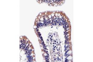 Paraformaldehyde-fixed, paraffin embedded human stomach tissue, Antigen retrieval by boiling in sodium citrate buffer (pH6. (ALDH6A1 抗体)
