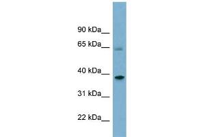 WB Suggested Anti-SNX7 Antibody Titration: 0. (Sorting Nexin 7 抗体  (Middle Region))