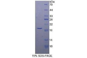SDS-PAGE (SDS) image for Signal Transducer and Activator of Transcription 3 (Acute-Phase Response Factor) (STAT3) (AA 135-279) protein (His tag) (ABIN2122088)
