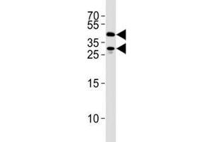 SIRT3 antibody western blot analysis in 293 cell lysate. (SIRT3 抗体  (AA 250-279))