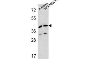 Western Blotting (WB) image for anti-L-2-Hydroxyglutarate Dehydrogenase (L2HGDH) antibody (ABIN2995585) (L2HGDH 抗体)