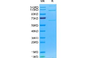 Mouse Complement component 3 on Tris-Bis PAGE under reduced condition. (C3 Protein (AA 25-1663) (His tag))