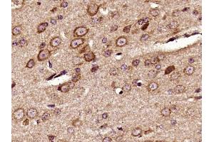 Paraformaldehyde-fixed, paraffin embedded mouse brain, Antigen retrieval by boiling in sodium citrate buffer (pH6) for 15min, Block endogenous peroxidase by 3% hydrogen peroxide for 30 minutes,  Blocking buffer (normal goat serum) at 37°C for 20min, Antibody incubation with Pyk2 (Tyr402) Polyclonal Antibody (bs-3400R) at 1:400 overnight at 4°C, followed by a conjugated secondary and DAB staining. (PTK2B 抗体  (pTyr402))