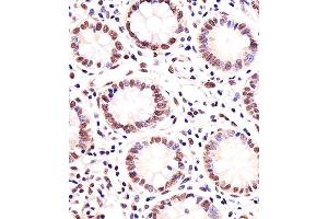 Immunohistochemical analysis of paraffin-embedded H. (MGMT 抗体)