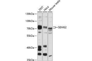 Western blot analysis of extracts of various cell lines, using SEMG2 antibody (ABIN6128756, ABIN6147529, ABIN6147531 and ABIN6216592) at 1:3000 dilution. (SEMG2 抗体  (AA 383-582))