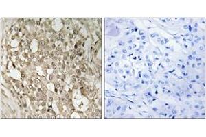 Immunohistochemistry (IHC) image for anti-Nuclear Factor-kB p65 (NFkBP65) (pSer529) antibody (ABIN2888481) (NF-kB p65 抗体  (pSer529))