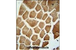 WDR49 antibody (C-term) (ABIN654826 and ABIN2844501) immunohistochemistry analysis in formalin fixed and paraffin embedded human skeletal muscle followed by peroxidase conjugation of the secondary antibody and DAB staining. (WDR49 抗体  (C-Term))