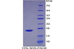 SDS-PAGE analysis of Human ADAMTS4 Protein. (ADAMTS4 蛋白)