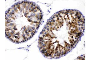 Immunohistochemistry (IHC) image for anti-WNK Lysine Deficient Protein Kinase 1 (WNK1) (AA 1154-1195), (Middle Region) antibody (ABIN4886765)