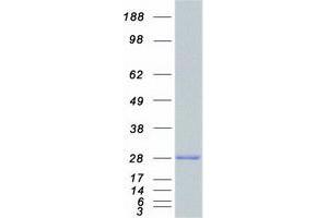 Western Blotting (WB) image for RAB5A, Member RAS Oncogene Family (RAB5A) protein (Myc-DYKDDDDK Tag) (ABIN2730360)