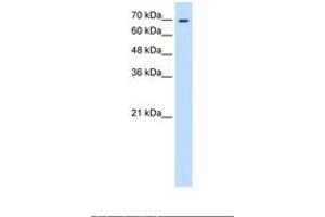 Image no. 1 for anti-Transglutaminase 2 (C Polypeptide, Protein-Glutamine-gamma-Glutamyltransferase) (TGM2) (N-Term) antibody (ABIN6738366) (Transglutaminase 2 抗体  (N-Term))