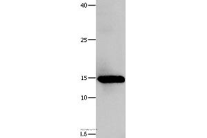 Western blot analysis of Human fetal muscle tissue, using LGALS1 Polyclonal Antibody at dilution of 1:500 (LGALS1/Galectin 1 抗体)