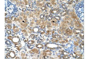 UBXD2 antibody was used for immunohistochemistry at a concentration of 4-8 ug/ml. (UBXD2 抗体  (Middle Region))