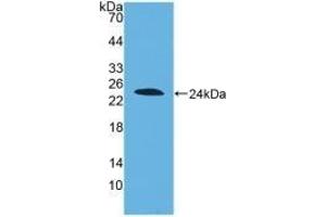 Detection of Recombinant DISC1, Human using Polyclonal Antibody to Disrupted In Schizophrenia 1 (DISC1) (DISC1 抗体  (AA 102-261))