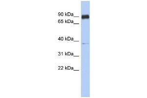 WB Suggested Anti-CCDC157 Antibody Titration: 0. (CCDC157 抗体  (Middle Region))