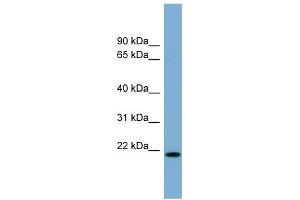 CYBA antibody used at 1 ug/ml to detect target protein. (CYBA 抗体  (Middle Region))