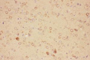Anti-CNTF Picoband antibody,  IHC(P): Rat Brain Tissue (CNTF 抗体  (AA 2-200))