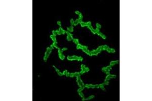 α-Bungarotoxin-FITC in whole mount staining of mice Gastrocnemius muscle. (alpha-Bungarotoxin protein (FITC))