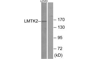 Western blot analysis of extracts from LOVO cells, using LMTK2 antibody. (LMTK2 抗体  (Internal Region))