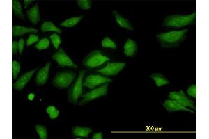 Immunofluorescence of monoclonal antibody to ROCK2 on HeLa cell. (ROCK2 抗体  (AA 1279-1388))