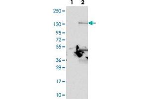 Western blot analysis of Lane 1: Negative control (vector only transfected HEK293T lysate). (PLEKHA7 抗体)