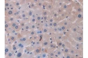 Detection of FTMT in Mouse Liver Tissue using Polyclonal Antibody to Ferritin, Mitochondrial (FTMT) (Ferritin Mitochondrial 抗体  (AA 54-229))
