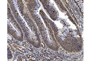 IHC analysis of PRDM14 using anti-PRDM14 antibody (ABIN7603152).