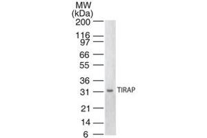 Western blot analysis of TIRAP. (TIRAP 抗体)