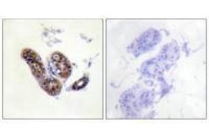 Immunohistochemistry analysis of paraffin-embedded human skin tissue using MITF (Ab-180/73) antibody. (MITF 抗体  (Ser73, Ser180))