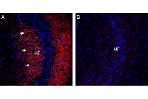 Expression of Synaptophysin in mouse hippocampus. (Synaptophysin 抗体  (Intravesicular Loop))