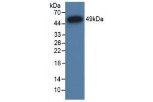 Western Blot; Sample: Recombinant NR3C1, Human. (Glucocorticoid Receptor 抗体  (AA 598-755))