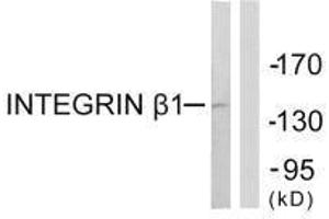 Western blot analysis of extracts from Jurkat cells, using Integrin β1 (Ab-789) antibody. (ITGB1 抗体  (Thr789))