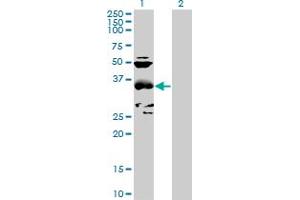 Western Blot analysis of CCBL1 expression in transfected 293T cell line by CCBL1 MaxPab polyclonal antibody. (CCBL1 抗体  (AA 1-374))