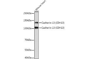 Western blot analysis of extracts of Mouse heart, using Cadherin-13 (CDH13) Rabbit mAb (ABIN7265996) at 1:1000 dilution. (Cadherin 13 抗体)