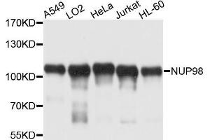Western blot analysis of extracts of various cell lines, using NUP98 antibody (ABIN5970195) at 1/1000 dilution. (NUP98 抗体)
