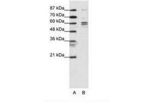 Image no. 1 for anti-General Transcription Factor IIF, Polypeptide 1, 74kDa (GTF2F1) (N-Term) antibody (ABIN6736098) (GTF2F1 抗体  (N-Term))