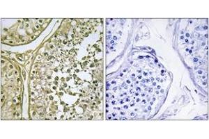 Immunohistochemistry analysis of paraffin-embedded human testis tissue, using CKI-alpha1/L Antibody. (CSNK1A1L 抗体  (AA 141-190))