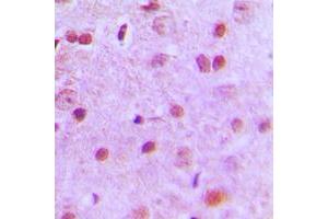 Immunohistochemical analysis of NFYA staining in human brain formalin fixed paraffin embedded tissue section. (NFYA 抗体  (C-Term))