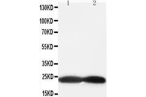 Anti-BAK antibody, Western blotting All lanes: Anti BAK  at 0. (BAK1 抗体  (Middle Region))