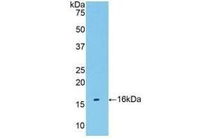 Detection of Recombinant TMEM27, Human using Polyclonal Antibody to Transmembrane Protein 27 (TMEM27) (TMEM27 抗体  (AA 17-137))