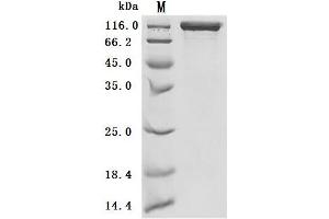 (Tris-Glycine gel) Discontinuous SDS-PAGE (reduced) with 5 % enrichment gel and 15 % separation gel.